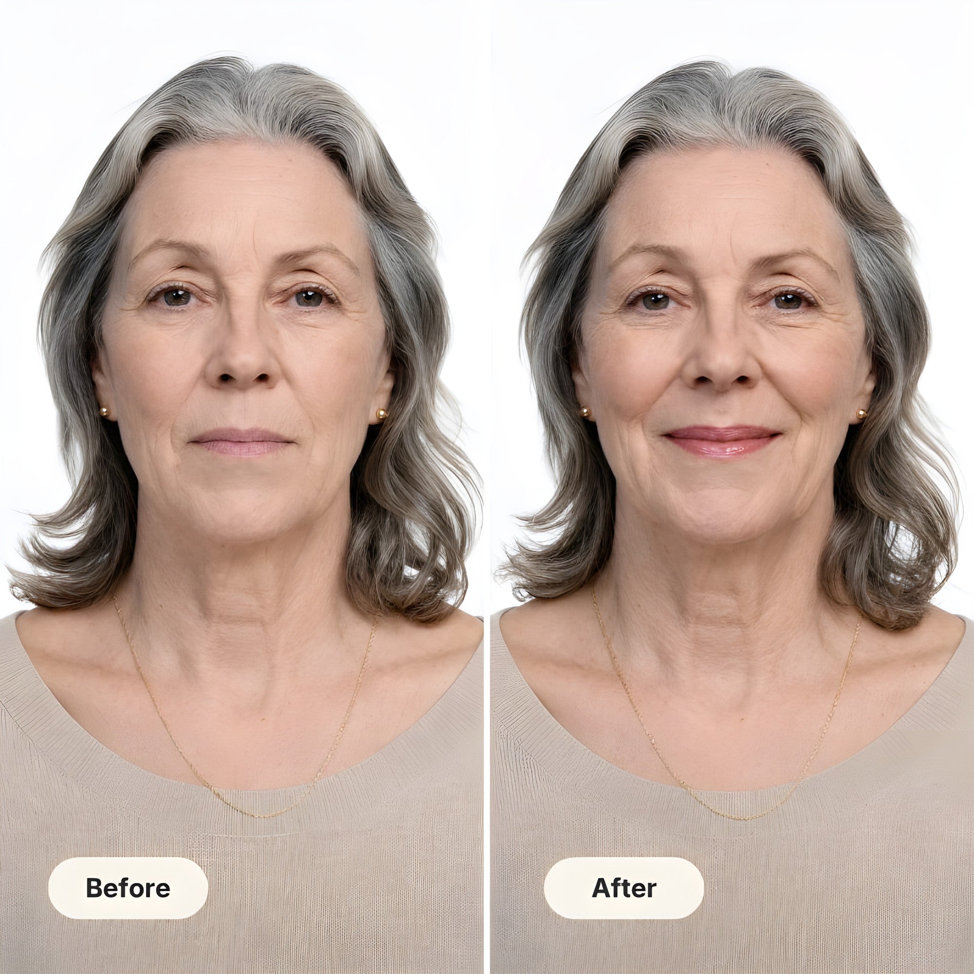 Before and after